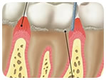 Periodontia